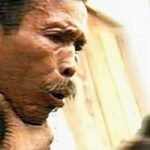 Ratusan Penderita dan Suspek TBC Tersebar di Kota Taman