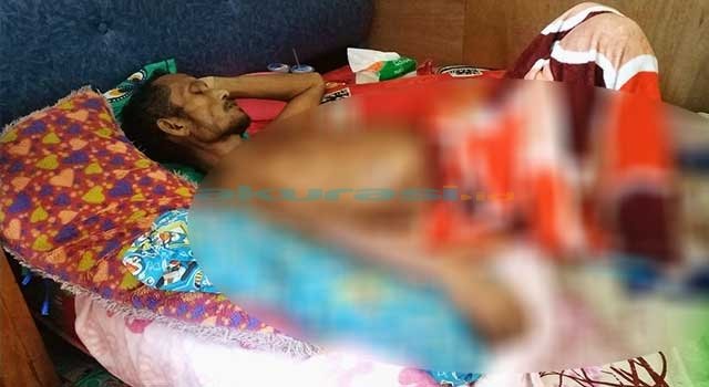 Penderita Tumor Usus yang Ditolak Operasi