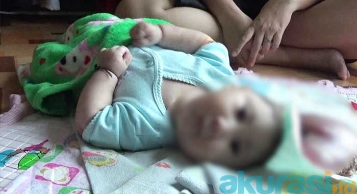 Idap Penyakit Miniongkel, Balita 5 Bulan Butuh Uluran Pemerintah Samarinda