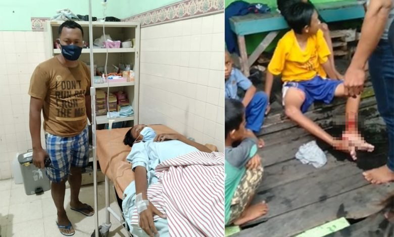 Lagi Asik Berenang, Bocah Asal Lok Tuan Bontang Lolos dari Terkaman Buaya Usai Bertarung Sengit Dalam Air