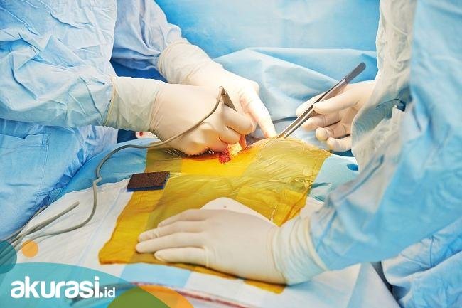 Perdana di Dunia, Seorang Pria di AS Jalani Transplantasi Jantung Babi