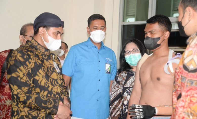 Berikan Pelayanan Terbaik, BPJS Ketenagakerjaan Jamin Pemasangan Protese Tangan Robotik Pekerja Yang Alami Kecelakaan Kerja