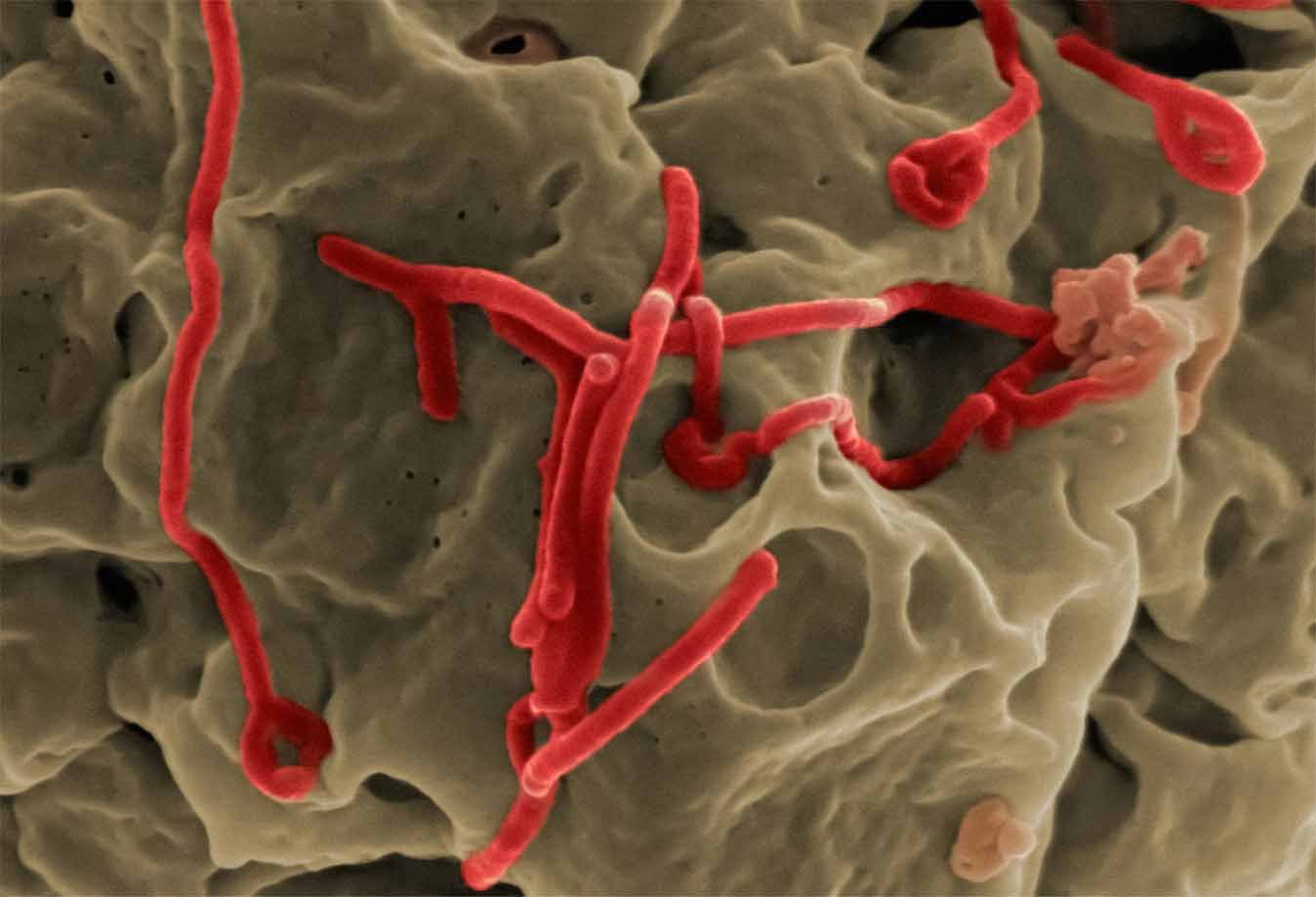 Ilmuwan China Ciptakan Virus Ebola Mutan yang Lebih Mematikan